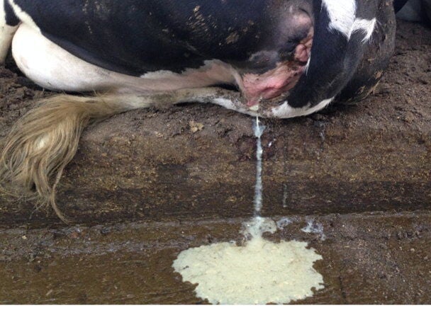 AKUT METRİTİS (RAHİM İLTİHABI)